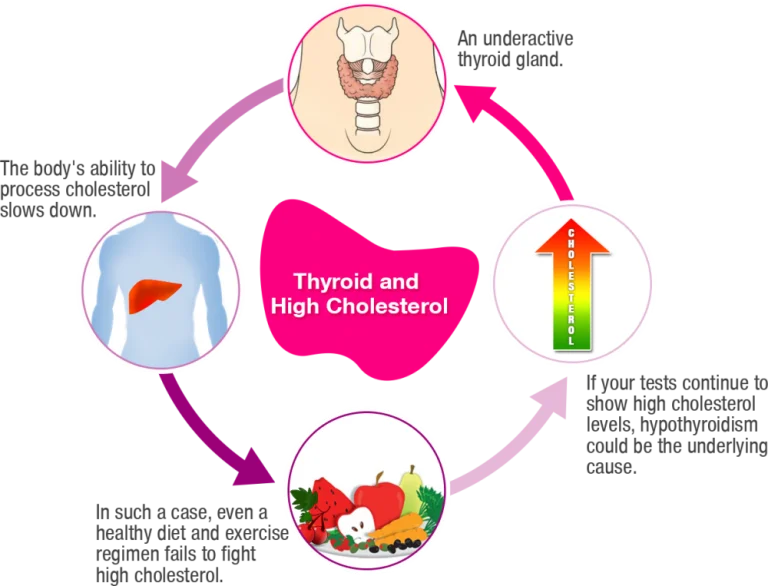 Υποθυρεοειδισμός, θυρεοειδίτιδα Hashimoto και διατροφή